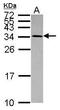 Unconventional SNARE In The ER 1 antibody, PA5-31265, Invitrogen Antibodies, Western Blot image 