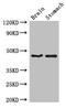 TBC1 Domain Family Member 20 antibody, CSB-PA846594LA01HU, Cusabio, Western Blot image 