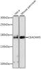 Carcinoembryonic Antigen Related Cell Adhesion Molecule 5 antibody, GTX55562, GeneTex, Western Blot image 