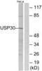 Ubiquitin Specific Peptidase 30 antibody, PA5-39509, Invitrogen Antibodies, Western Blot image 