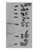 Cholesteryl Ester Transfer Protein antibody, NBP1-57982, Novus Biologicals, Western Blot image 