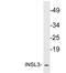 Insulin Like 3 antibody, LS-B11421, Lifespan Biosciences, Western Blot image 