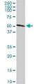 UDP Glucuronosyltransferase Family 2 Member B15 antibody, H00007366-D01P, Novus Biologicals, Western Blot image 