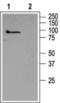 Short transient receptor potential channel 5 antibody, PA5-77310, Invitrogen Antibodies, Western Blot image 