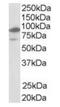 Nuclear Receptor Subfamily 1 Group H Member 2 antibody, orb18918, Biorbyt, Western Blot image 