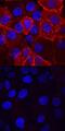 Insulin Receptor antibody, AF2507, R&D Systems, Immunocytochemistry image 