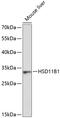 Hydroxysteroid 11-Beta Dehydrogenase 1 antibody, GTX66405, GeneTex, Western Blot image 