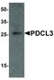 Phosducin Like 3 antibody, LS-B12151, Lifespan Biosciences, Western Blot image 
