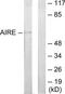 Autoimmune regulator antibody, TA313460, Origene, Western Blot image 