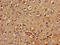 TYRO3 Protein Tyrosine Kinase antibody, LS-B15188, Lifespan Biosciences, Immunohistochemistry paraffin image 
