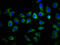 S100 Calcium Binding Protein A9 antibody, LS-B12993, Lifespan Biosciences, Immunofluorescence image 