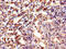 Aspartate Beta-Hydroxylase antibody, CSB-PA002226HA01HU, Cusabio, Immunohistochemistry frozen image 