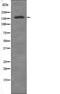 Mediator Complex Subunit 1 antibody, PA5-64703, Invitrogen Antibodies, Western Blot image 