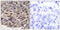 Eukaryotic Translation Initiation Factor 4E Binding Protein 1 antibody, LS-C117283, Lifespan Biosciences, Immunohistochemistry paraffin image 