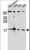 Fibroblast Growth Factor 22 antibody, LS-C166136, Lifespan Biosciences, Western Blot image 