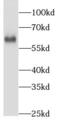 NOP58 Ribonucleoprotein antibody, FNab05796, FineTest, Western Blot image 