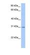 Hydroxyacylglutathione Hydrolase antibody, NBP1-56674, Novus Biologicals, Western Blot image 