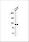 Matrilin 2 antibody, A06462-1, Boster Biological Technology, Western Blot image 