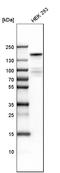 Lysine-specific demethylase 6A antibody, HPA002111, Atlas Antibodies, Western Blot image 
