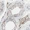 LY6G6D antibody, NBP1-86749, Novus Biologicals, Immunohistochemistry paraffin image 