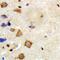 TNF Receptor Associated Factor 6 antibody, orb338952, Biorbyt, Immunohistochemistry paraffin image 