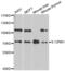 Interleukin 12 Receptor Subunit Beta 1 antibody, abx001549, Abbexa, Western Blot image 