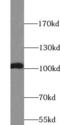 ATPase Na+/K+ Transporting Subunit Alpha 1 antibody, FNab00691, FineTest, Western Blot image 