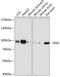 Endoglin antibody, 13-161, ProSci, Western Blot image 