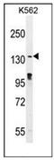 Ovostatin homolog antibody, AP53137PU-N, Origene, Western Blot image 