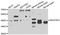 NADH:Ubiquinone Oxidoreductase Complex Assembly Factor 5 antibody, A7135, ABclonal Technology, Western Blot image 