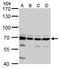 Cleavage And Polyadenylation Specific Factor 6 antibody, GTX115537, GeneTex, Western Blot image 