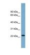 ADP Ribosylation Factor Like GTPase 8B antibody, NBP1-56577, Novus Biologicals, Western Blot image 