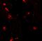 Rab Interacting Lysosomal Protein Like 1 antibody, A14157, Boster Biological Technology, Immunofluorescence image 