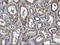 Parvin Alpha antibody, M03255, Boster Biological Technology, Immunohistochemistry paraffin image 