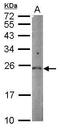 Pyroglutamyl-Peptidase I antibody, GTX106120, GeneTex, Western Blot image 