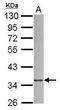 Actin Related Protein 2/3 Complex Subunit 1B antibody, GTX115344, GeneTex, Western Blot image 