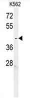 Chromosome 6 Open Reading Frame 58 antibody, AP50659PU-N, Origene, Western Blot image 