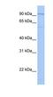 Tetratricopeptide Repeat Domain 16 antibody, NBP1-55177, Novus Biologicals, Western Blot image 