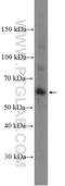Matrix Metallopeptidase 1 antibody, 26585-1-AP, Proteintech Group, Western Blot image 