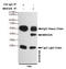 Mitogen-Activated Protein Kinase Kinase 6 antibody, STJ99282, St John