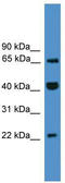 Transcription Elongation Factor A Like 6 antibody, TA342117, Origene, Western Blot image 