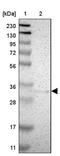 Myeloid Leukemia Factor 2 antibody, PA5-52745, Invitrogen Antibodies, Western Blot image 