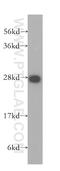 Prostaglandin D2 Synthase antibody, 10754-2-AP, Proteintech Group, Western Blot image 