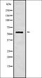 Glutathione S-Transferase Kappa 1 antibody, orb336889, Biorbyt, Western Blot image 