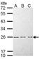 HRas Proto-Oncogene, GTPase antibody, LS-B10865, Lifespan Biosciences, Western Blot image 