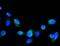 G Protein-Coupled Receptor Kinase 2 antibody, A01473-1, Boster Biological Technology, Immunofluorescence image 