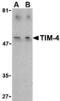 T Cell Immunoglobulin And Mucin Domain Containing 4 antibody, MBS150685, MyBioSource, Western Blot image 
