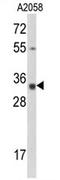 Calponin 3 antibody, AP17171PU-N, Origene, Western Blot image 