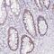 KIAA0937 antibody, NBP2-34161, Novus Biologicals, Immunohistochemistry paraffin image 
