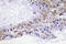 CFL1 antibody, LS-C177996, Lifespan Biosciences, Immunohistochemistry paraffin image 